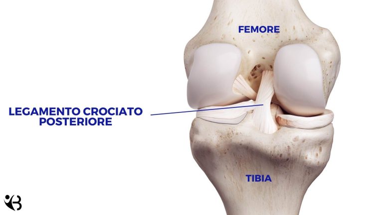 Crociato Anteriore Rotto Sintomi Cosa Fare Esercizi E Tempi Di Recupero Dott Valerio