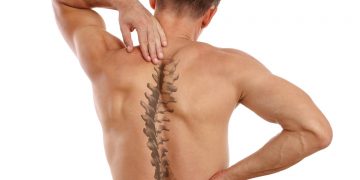 Scoliosi e mal di schiena: verità, sintomi e rimedi